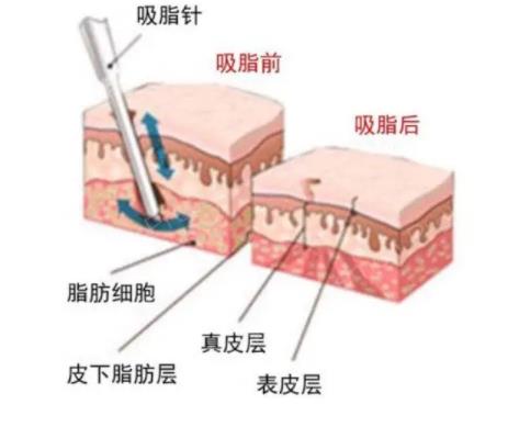 衡水整形医院唯美和瑞美哪个好？业内人士整理出医生简介及擅长项目送上