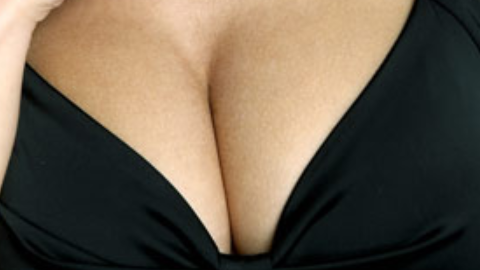 隆胸手术是怎样做的?隆胸手术可以顺便切除副乳吗?