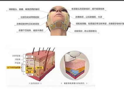 超声刀有哪些作用?适合哪些人群