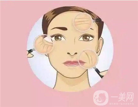 热玛吉拉皮除皱多少钱？