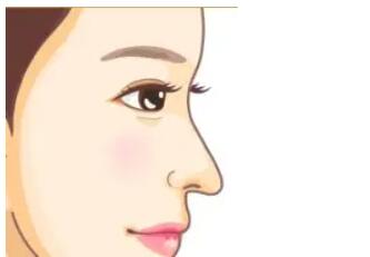 隆鼻动漫35.jpg 隆鼻动漫35.jpg