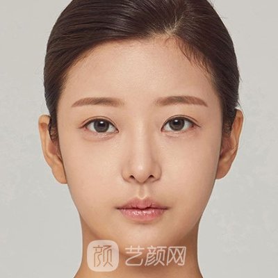 武汉美妍高科医疗美容去眼袋的价格贵吗？官网价格表及实例出炉