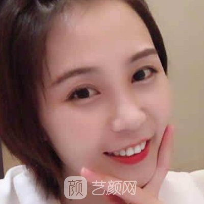 武汉康美莱医疗美容医院好不好？除皱嫩肤实例及成果图公布