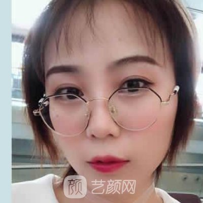 武汉康美莱医疗美容医院好不好？除皱嫩肤实例及成果图公布