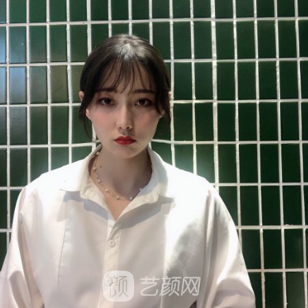 宁波典范整形医院点阵激光实例公开｜附体验对比图