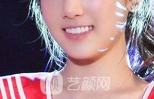 徐州市第一人民医院牙齿矫正价格贵吗?多少钱?附实例