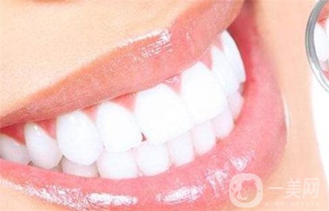 装个烤瓷牙多少钱 种类 过程 怎么装？