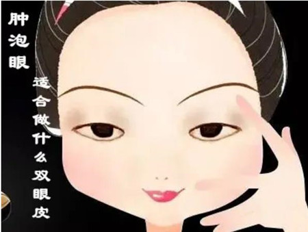 双眼皮失败体现在哪些方面