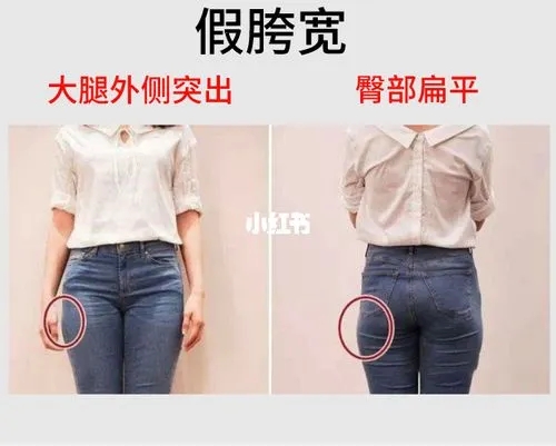 假胯宽能够改善吗?