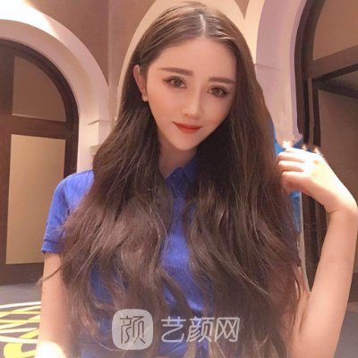 长沙华韩华美医疗美容医院光子嫩肤正规吗？2022案例分享