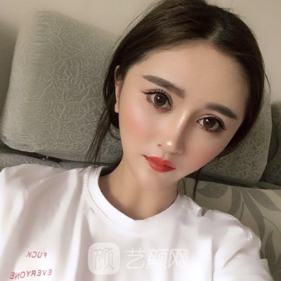 长沙华韩华美医疗美容医院光子嫩肤正规吗？2022案例分享