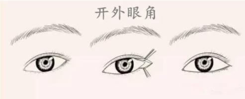 开眼角是开前面还是后面？外眼角适合什么眼型?