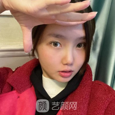 昆明彩美堂医疗美容诊所怎么样？全新瘦脸除皱案例公布