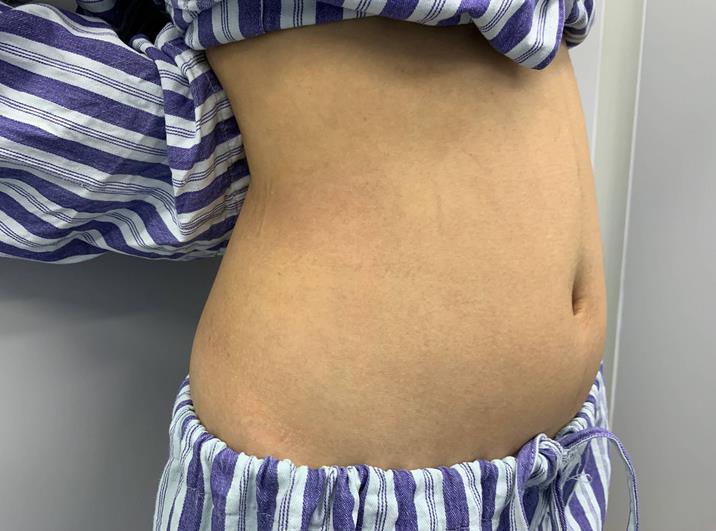 1.jpg 【探索】苏州市立医院整形外科(价目)