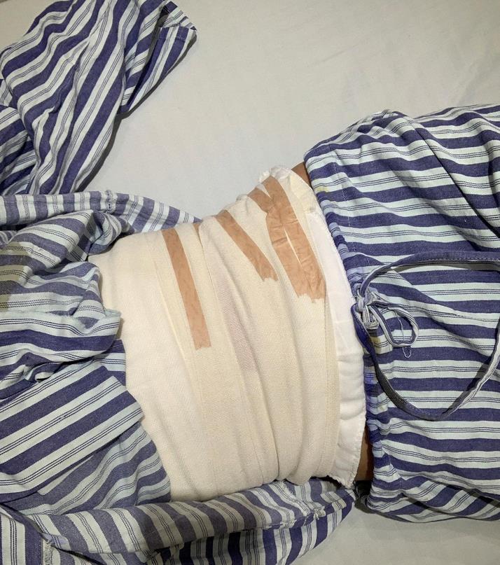 3.jpg 【探索】苏州市立医院整形外科(价目)