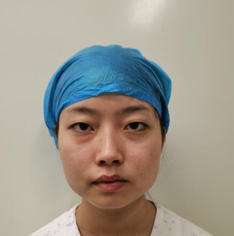 说说，苏州附一院整形美容科