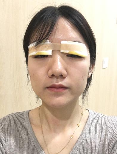 1.jpg 2022厦门大学附属中山医院整形科价目_