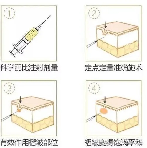 u=1855642506,1714309522&fm=253&fmt=auto&app=138&f=JPEG.webp.jpg 网友点赞!山西大学医院整形科(价目)