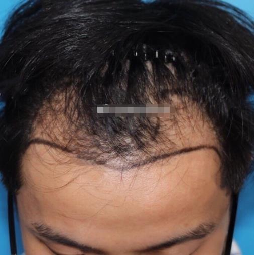 1.jpg 扩散!奉化中医院整形外科(价目)