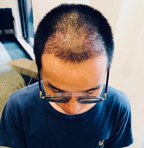 2.jpg 扩散!奉化中医院整形外科(价目)