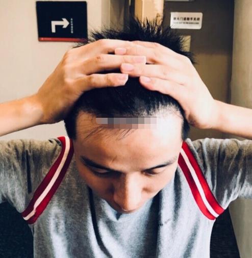 3.jpg 扩散!奉化中医院整形外科(价目)