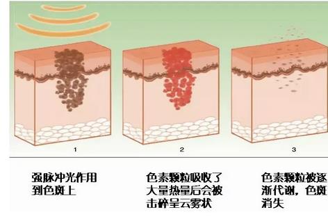 微信截图_20220428170130.jpg 2022天长市人民医院激光美容中心