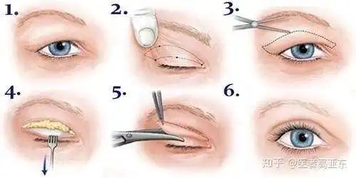 2022年宁波妇儿医院整形外科