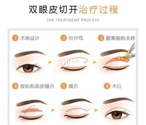 2022年宁波妇儿医院整形外科