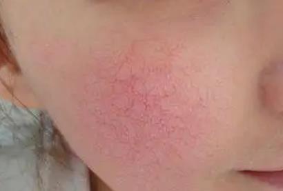 2022上海市同济医院整形科