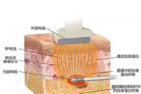 2022解放军总医院整形科第七医学中心