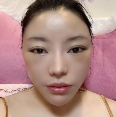 3.jpg 【较新】中山大学附属第一医院整形外科(价目)