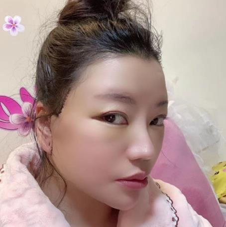 4.jpg 【较新】中山大学附属第一医院整形外科(价目)