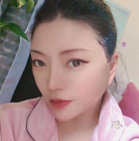 5.jpg 【较新】中山大学附属第一医院整形外科(价目)