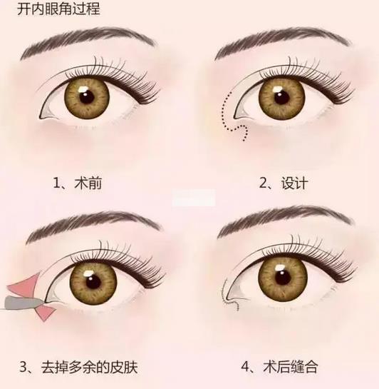 微信截图_20220328161604.jpg 公开2022兰大二院整形科价目