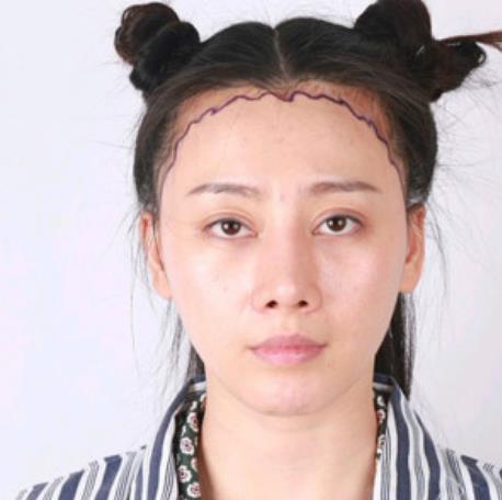 1.jpg 2022年,中国医科大学附属第一医院整形科(价目)