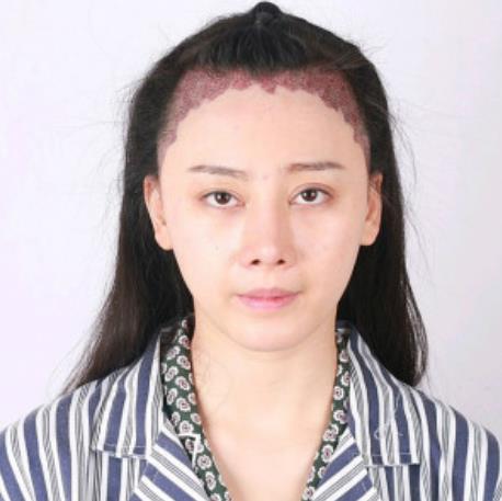 2.jpg 2022年,中国医科大学附属第一医院整形科(价目)