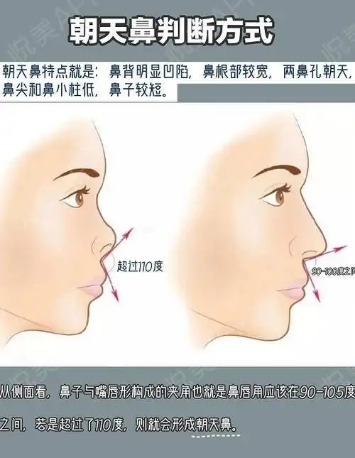 src=http%3A%2F%2Fp23.yuemei.com%2Fpostimg%2F20210114%2F500_500%2F210114133347_b8159b.jpg&refer=h 2022年,深圳港大医院整形科(价目)