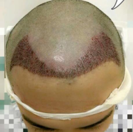 1.jpg 好!消!息!深圳建安医疗美容医院