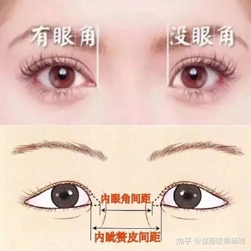 u=4188995652,2362726487&fm=253&fmt=auto&app=120&f=JPEG.webp.jpg 重磅更新!重庆佰视佳眼科(近视眼手术)