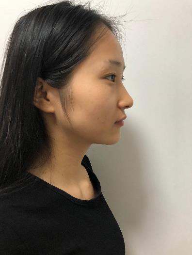 2022洛阳中心医院整形美容科（价目）