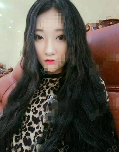 【关注】温州医科大学附属第二医院整形科玻尿酸