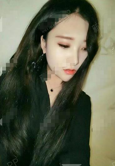 【关注】温州医科大学附属第二医院整形科玻尿酸