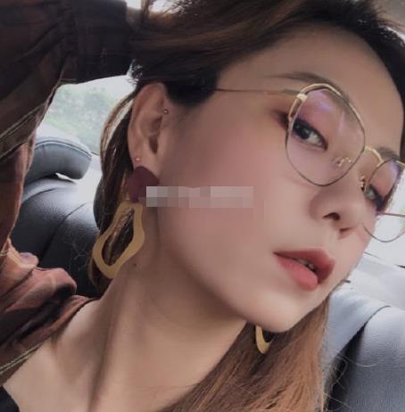 揭晓，西安顺美整形美容门诊部