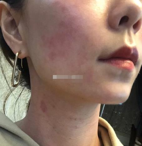 揭晓，西安顺美整形美容门诊部