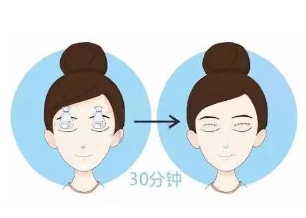 眼袋有哪些类型?去眼袋的方法汇总