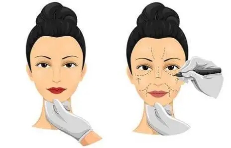 2022年，新余第二医院整形科