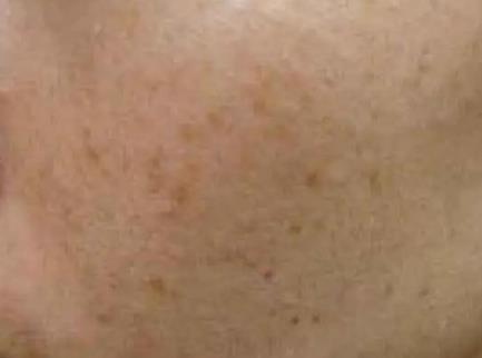 2022双辽市第一人民医院整形科