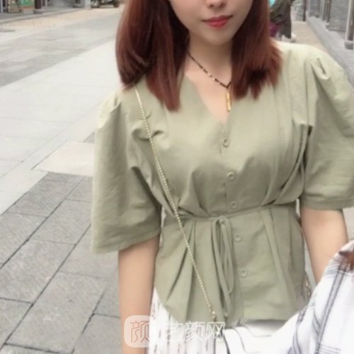 赣州亚韩医疗美容吸脂怎么样？2022招牌实例一览