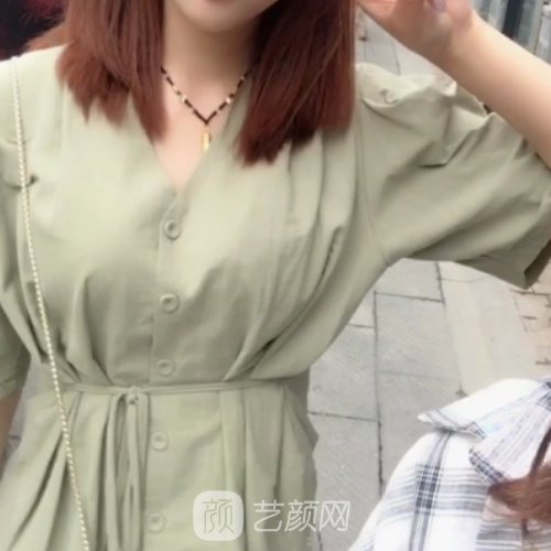 赣州德尔美客整形医院靠谱吗？吸脂实例及成果图分享