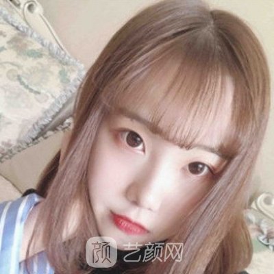 深圳容术医疗美容门诊部正规吗？2022双眼皮实例曝光
